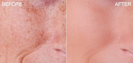 PT Portraitٷ湦ܽܺͰװ